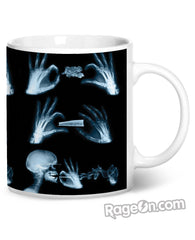X-Ray Coffee Mug